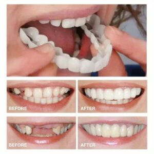 4-Pack, Comfortable and Flexible White Dentures Veneer with Upper and Lower Alveolar Attachment, Easy to Wear, Unisex