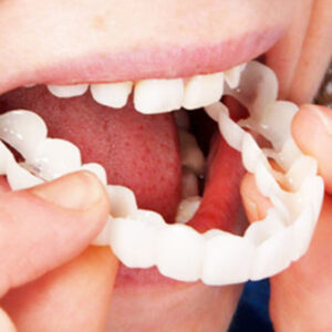 Two-Piece Set, Comfortable And Flexible White Denture Veneers with Upper And Lower Denture Accessories, Suitable for Both Men And Women