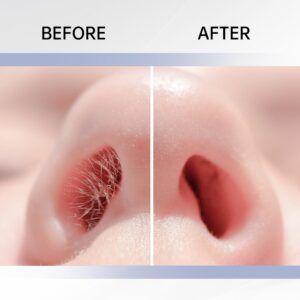 12/8pcs Dual-Sided Nose Hair Trimmer, 2-in-1 Nose Hair Removal Tool, Portable Manual 360° Rotating Nose Hair Trimmer with Ear Pick, Suitable for Women and Me