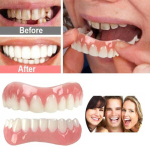 1 Set Upper & Lower Gum Veneers Dentures - Instant Smile Makeover, Natural-Looking Teeth Replacement, Comfortable & Easy to Use, Durable Plastic Material, Affordable Dental Solution for Men & Women, Ideal Holiday Gift for a Confident Smile