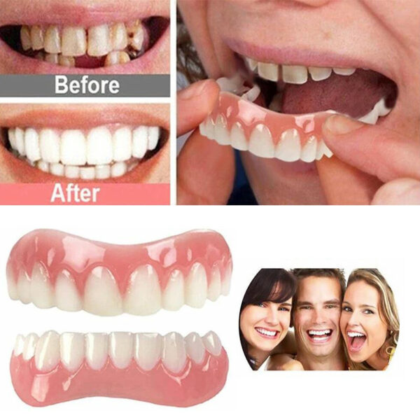 c927491d23e0469399421b207929526d-goods.jpeg 1 Set Upper & Lower Gum Veneers Dentures - Instant Smile Makeover, Natural-Looking Teeth Replacement, Comfortable & Easy to Use, Durable Plastic Material, Affordable Dental Solution for Men & Women, Ideal Holiday Gift for a Confident Smile